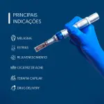 Derma Pen Caneta de Microagulhamento - Smart Gr