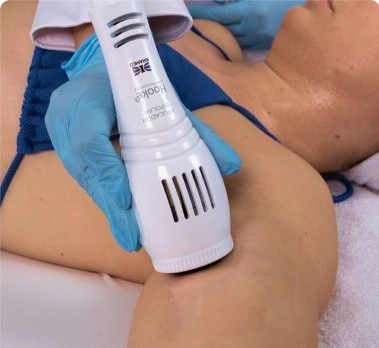 Mulher fazendo tratamento na axila