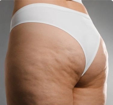 Posterior de uma mulher usando bikini branco
